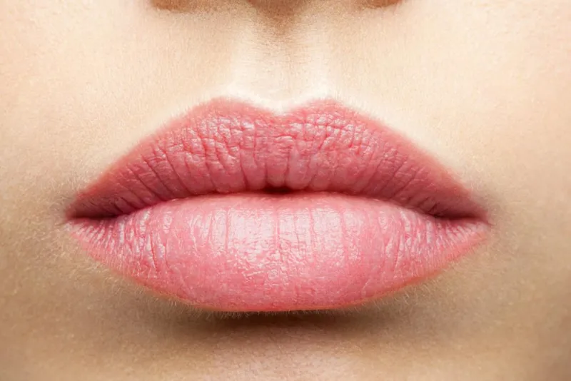 עיבוי שפתיים טבעי